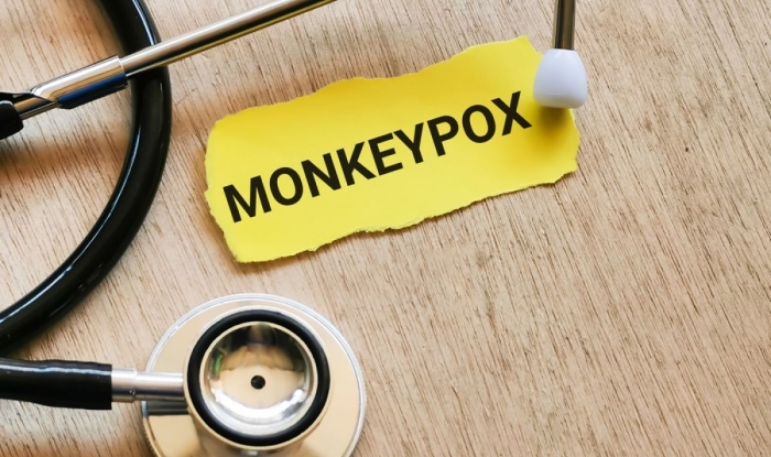 Здравните власти у нас с полезна информация за маймунската шарка