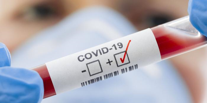 Новите случаи на COVID-19 в страната са 167